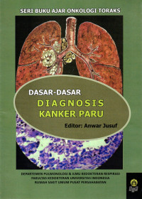 Image of DASAR-DASAR DIAGNOSIS KANKER PARU